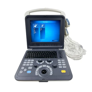 САЙ-A042-1 Висококачествен медицински ултразвуков уред за цветен доплер за лаптоп на добра цена