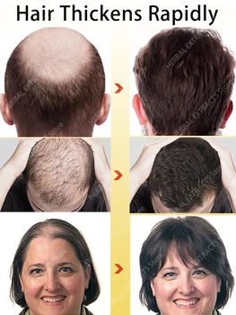 Серум За Бърз Растеж На Косата И За Лечение На Изтъняване На Косата